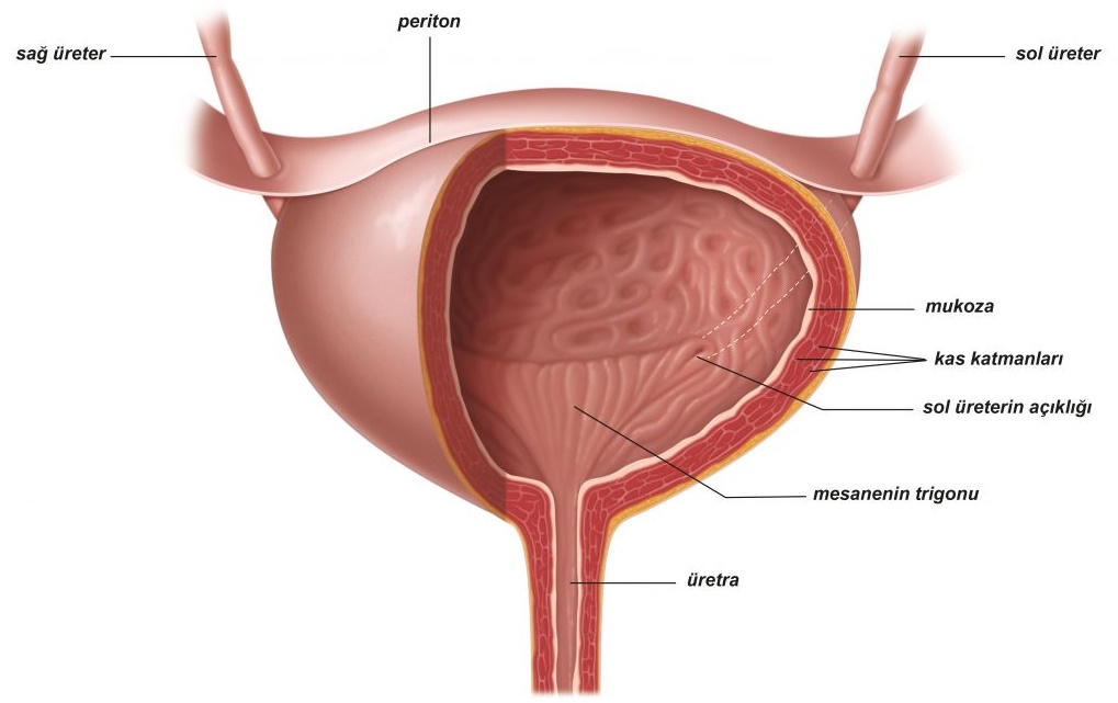 radikal sistektomi​